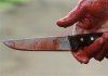 В Кременчугском районе двое больных в больнице устроили кровавую драку