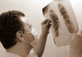 В Кременчуге проходит месячник борьбы с туберкулёзом