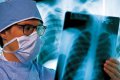 Смертность от туберкулёза в Полтавской области остаётся на уровне прошлого года